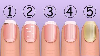 Choose Your Fingernail.